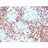 Immunohistochemistry - Anti-TdT Antibody [rDNTT/6909] (A277884) - Antibodies.com