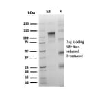 SDS-PAGE - Anti-TdT Antibody [rDNTT/6909] (A277884) - Antibodies.com