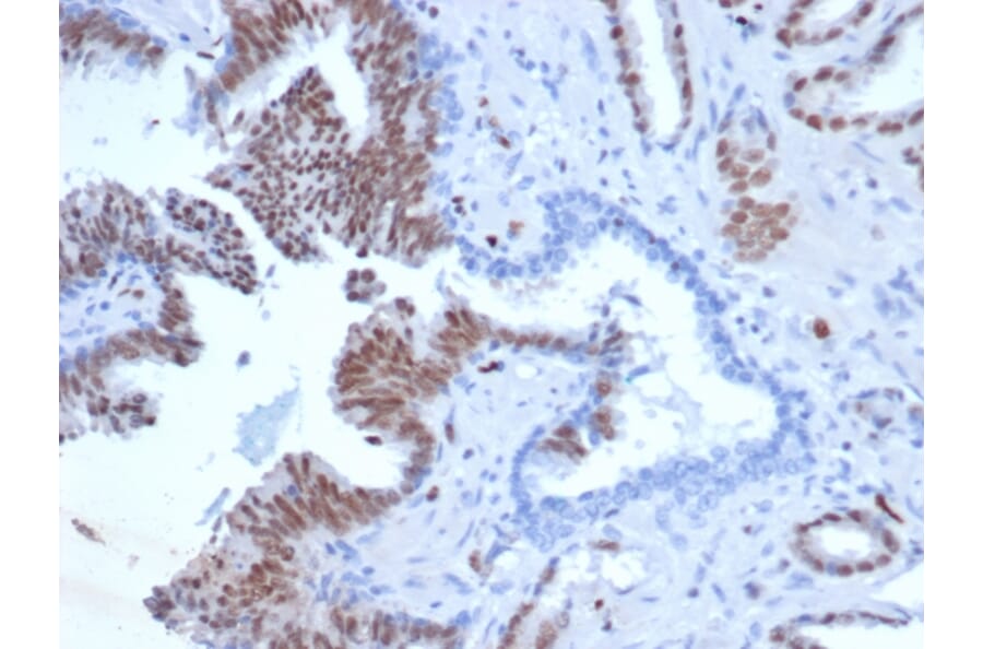 Immunohistochemistry - Anti-ERG Antibody [rERG/6843] (A277885) - Antibodies.com