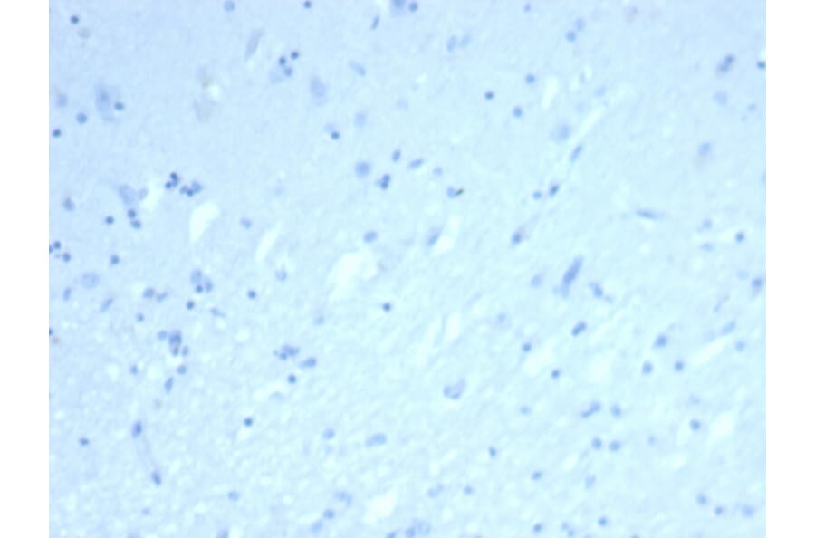 Immunohistochemistry - Anti-ERG Antibody [rERG/6843] (A277885) - Antibodies.com