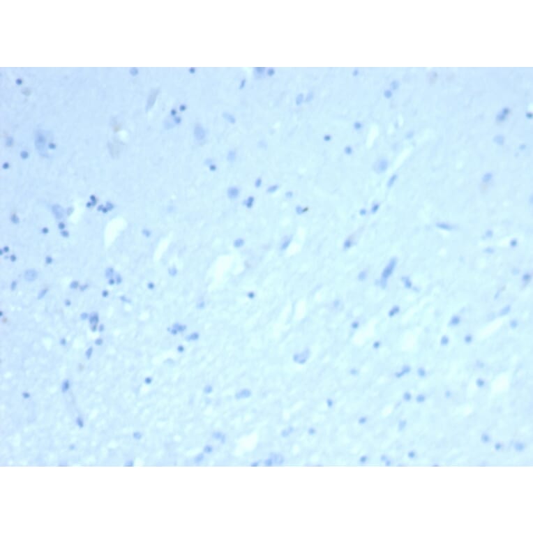 Immunohistochemistry - Anti-ERG Antibody [rERG/6843] (A277885) - Antibodies.com