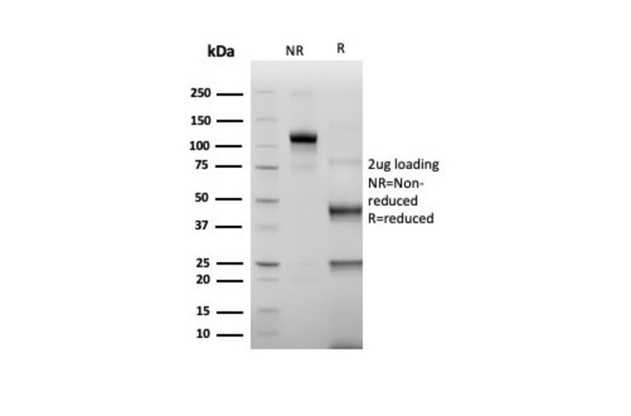 SDS-PAGE - Anti-ERG Antibody [rERG/6843] (A277885) - Antibodies.com