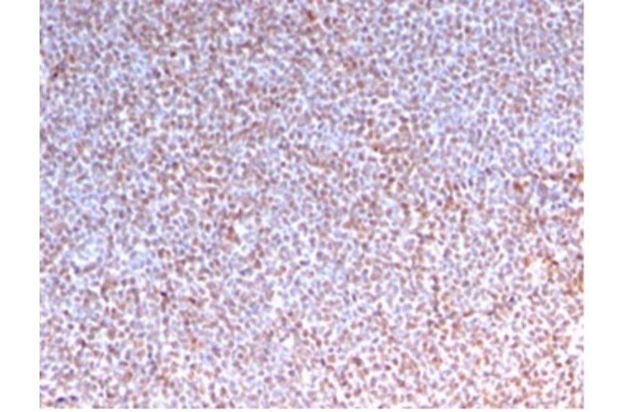 Immunohistochemistry - Anti-ALK Antibody [rALK1/1504] (A277887) - Antibodies.com
