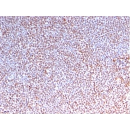 Immunohistochemistry - Anti-ALK Antibody [rALK1/1504] (A277887) - Antibodies.com