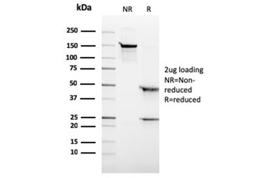 SDS-PAGE - Anti-ALK Antibody [rALK1/1504] (A277887) - Antibodies.com