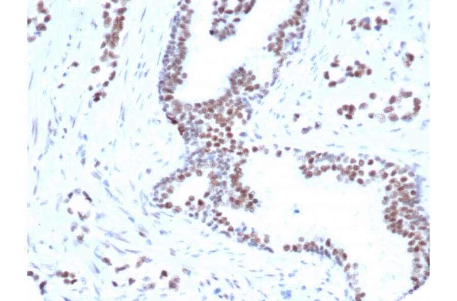 Immunohistochemistry - Anti-FOXP1 Antibody [rFOXP1/6902] (A277889) - Antibodies.com
