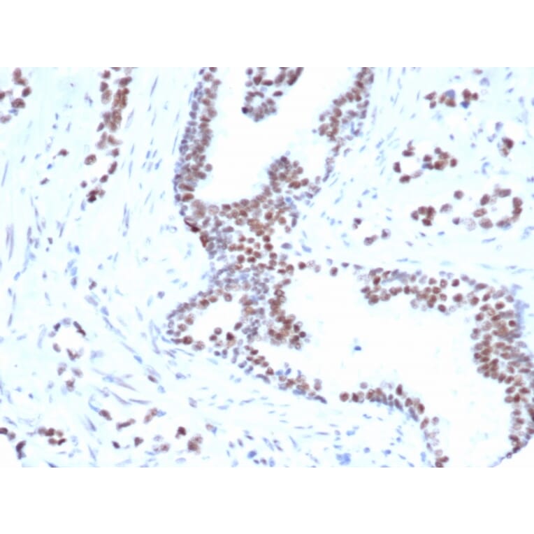 Immunohistochemistry - Anti-FOXP1 Antibody [rFOXP1/6902] (A277889) - Antibodies.com