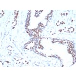 Immunohistochemistry - Anti-FOXP1 Antibody [rFOXP1/6902] (A277889) - Antibodies.com