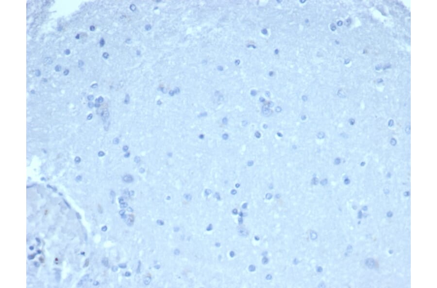 Immunohistochemistry - Anti-FOXP1 Antibody [rFOXP1/6902] (A277889) - Antibodies.com