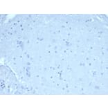 Immunohistochemistry - Anti-FOXP1 Antibody [rFOXP1/6902] (A277889) - Antibodies.com