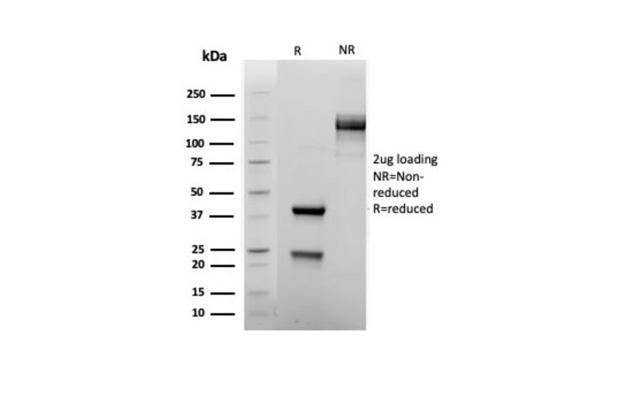 SDS-PAGE - Anti-FOXP1 Antibody [rFOXP1/6902] (A277889) - Antibodies.com
