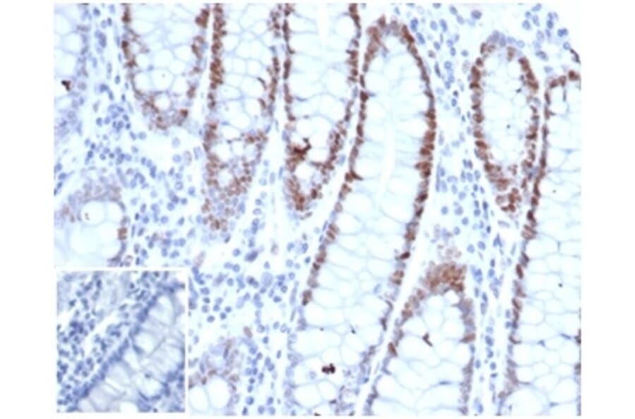 Immunohistochemistry - Anti-MSH6 Antibody [rMSH6/6846] (A277890) - Antibodies.com