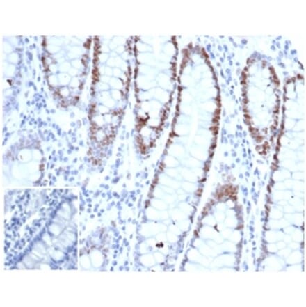Immunohistochemistry - Anti-MSH6 Antibody [rMSH6/6846] (A277890) - Antibodies.com