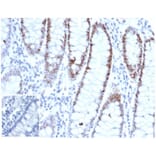 Immunohistochemistry - Anti-MSH6 Antibody [rMSH6/6846] (A277890) - Antibodies.com