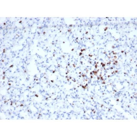 Immunohistochemistry - Anti-Granzyme B Antibody [rGZMB/6740] (A277891) - Antibodies.com