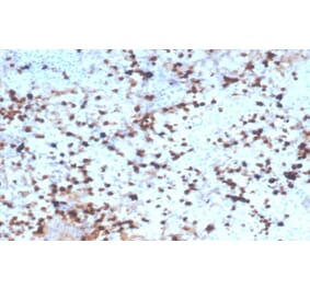 Immunohistochemistry - Anti-Granzyme B Antibody [rGZMB/4538] (A277892) - Antibodies.com