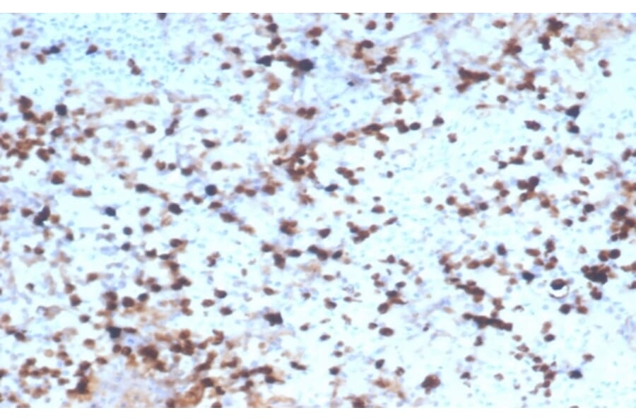 Immunohistochemistry - Anti-Granzyme B Antibody [rGZMB/4538] (A277892) - Antibodies.com