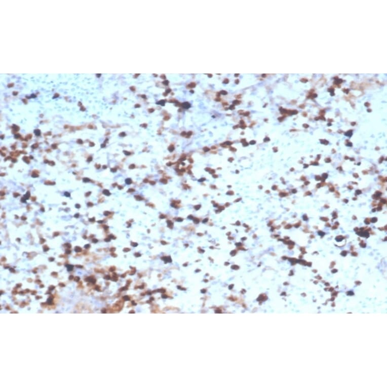 Immunohistochemistry - Anti-Granzyme B Antibody [rGZMB/4538] (A277892) - Antibodies.com