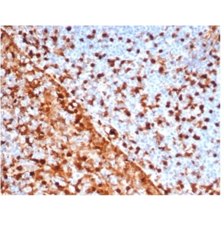 Immunohistochemistry - Anti-Annexin A1 Antibody [rANXA1/6451] (A277893) - Antibodies.com