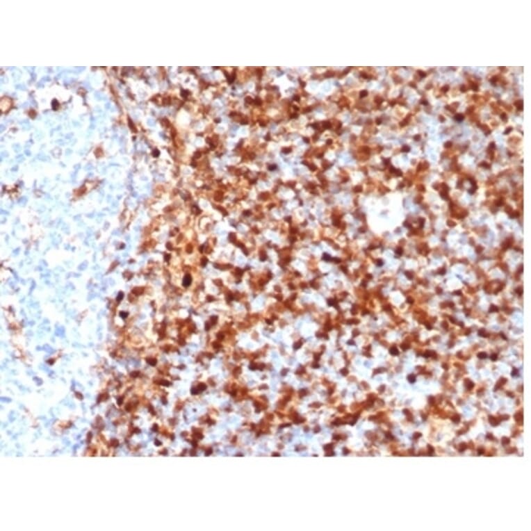 Immunohistochemistry - Anti-Annexin A1 Antibody [rANXA1/6451] (A277893) - Antibodies.com
