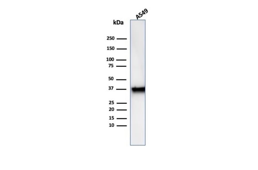 Western Blot - Anti-Annexin A1 Antibody [rANXA1/6451] (A277893) - Antibodies.com