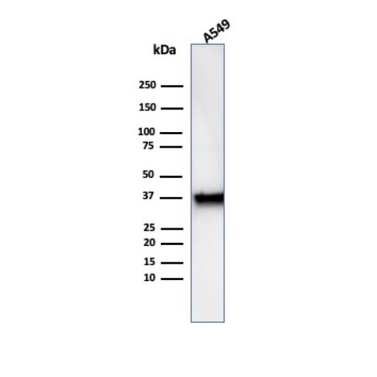 Western Blot - Anti-Annexin A1 Antibody [rANXA1/6451] (A277893) - Antibodies.com