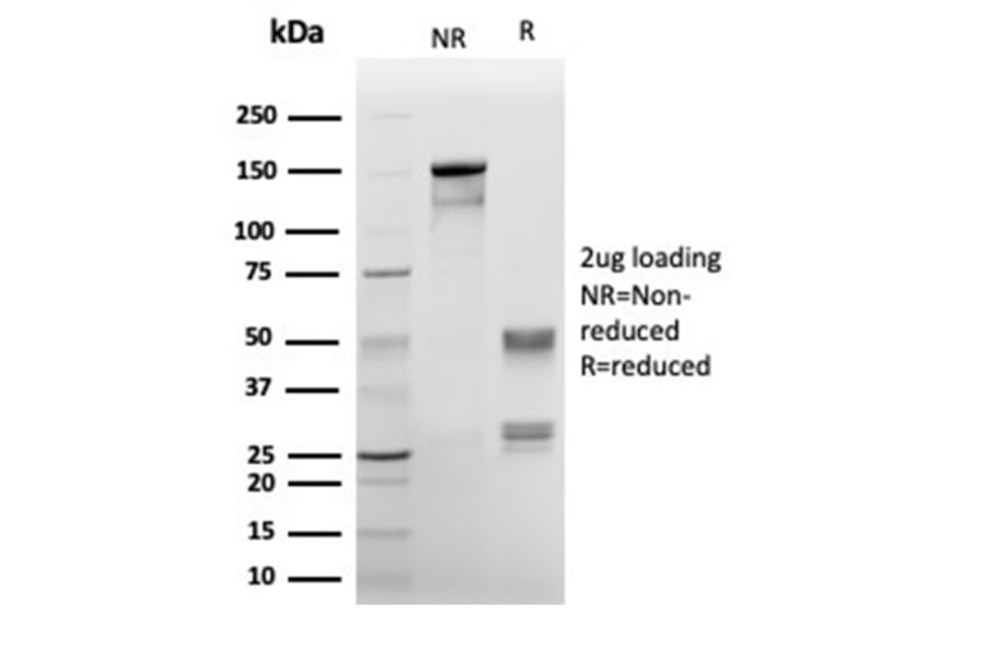 SDS-PAGE - Anti-Annexin A1 Antibody [rANXA1/6451] (A277893) - Antibodies.com