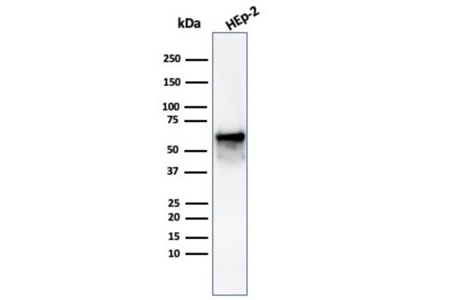 Western Blot - Anti-HSP60 Antibody [rHSPD1/6497] (A277894) - Antibodies.com