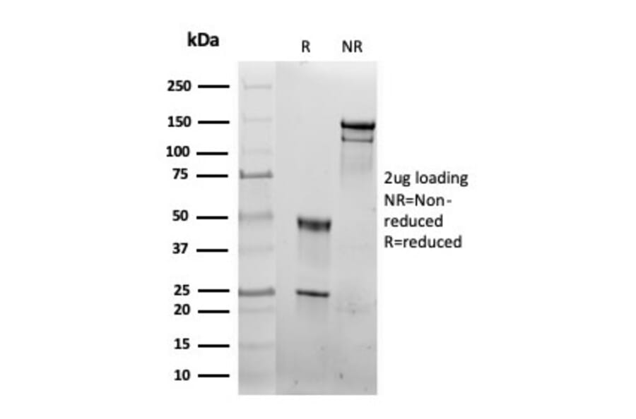 SDS-PAGE - Anti-HSP60 Antibody [rHSPD1/6497] (A277894) - Antibodies.com