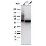 Western Blot - Anti-HSP60 Antibody [rHSPD1/6497] (A277894) - Antibodies.com