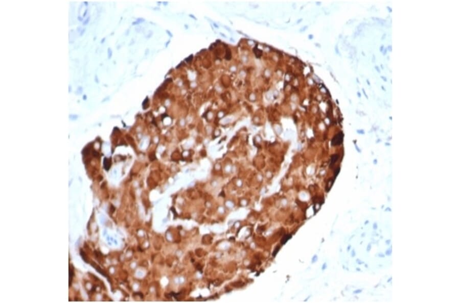 Immunohistochemistry - Anti-Inhibin alpha Antibody [rINHA/6919] (A277895) - Antibodies.com