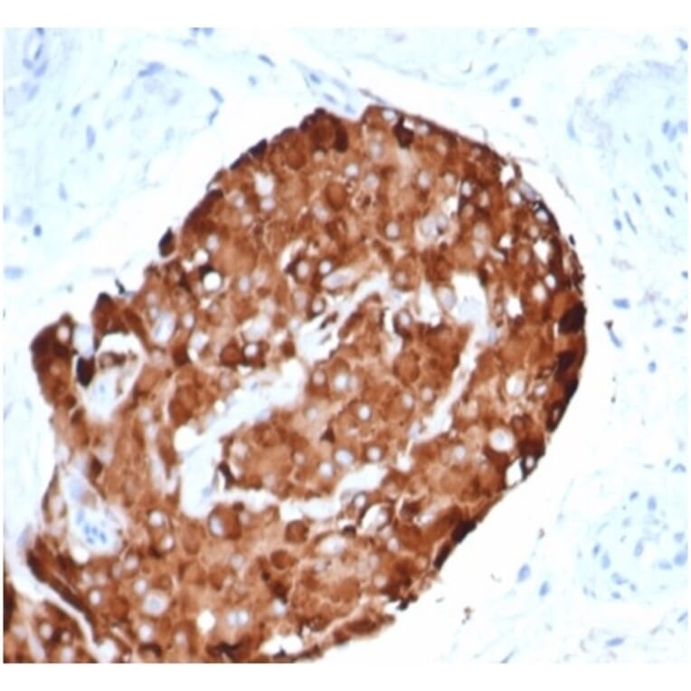 Immunohistochemistry - Anti-Inhibin alpha Antibody [rINHA/6919] (A277895) - Antibodies.com