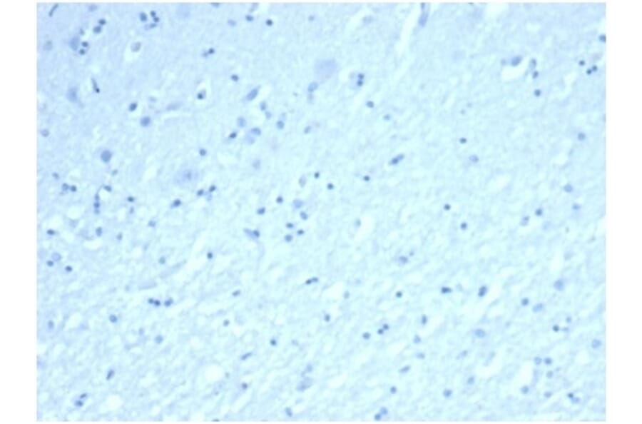 Immunohistochemistry - Anti-Inhibin alpha Antibody [rINHA/6919] (A277895) - Antibodies.com