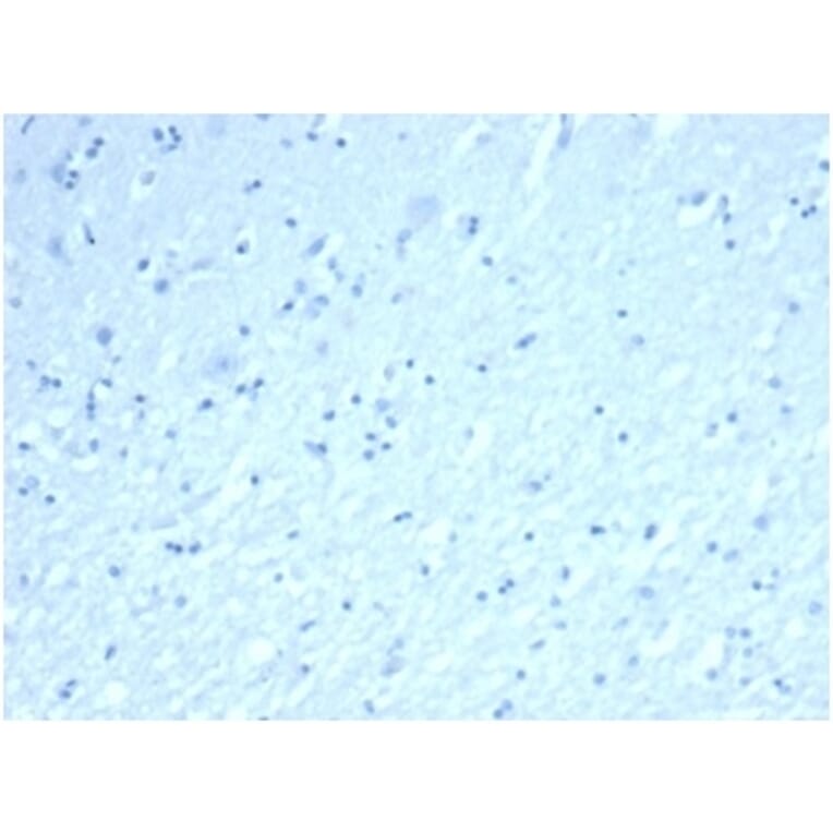 Immunohistochemistry - Anti-Inhibin alpha Antibody [rINHA/6919] (A277895) - Antibodies.com