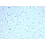 Immunohistochemistry - Anti-Inhibin alpha Antibody [rINHA/6919] (A277895) - Antibodies.com