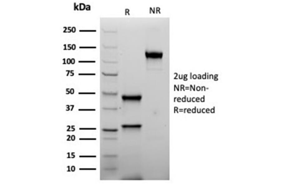 SDS-PAGE - Anti-Inhibin alpha Antibody [rINHA/6919] (A277895) - Antibodies.com