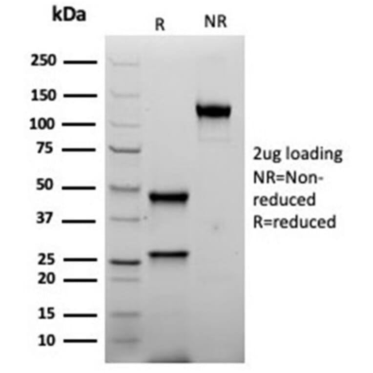 SDS-PAGE - Anti-Inhibin alpha Antibody [rINHA/6919] (A277895) - Antibodies.com