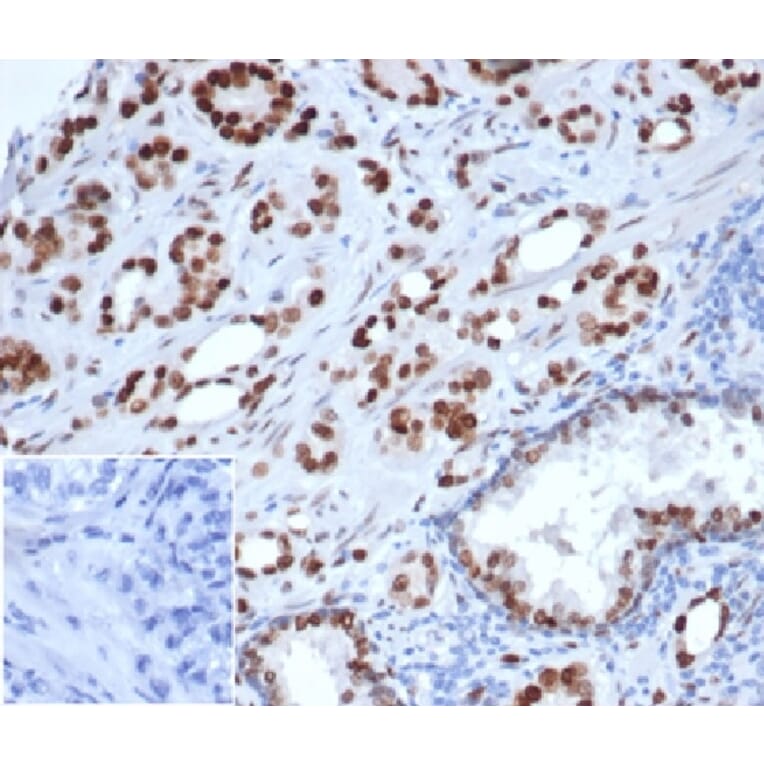Immunohistochemistry - Anti-Androgen Receptor Antibody [rDHTR/6818] (A277896) - Antibodies.com
