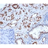 Immunohistochemistry - Anti-Androgen Receptor Antibody [rDHTR/6818] (A277896) - Antibodies.com