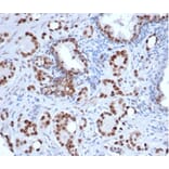 Immunohistochemistry - Anti-Androgen Receptor Antibody [rDHTR/6818] (A277896) - Antibodies.com