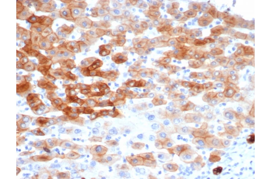Immunohistochemistry - Anti-Cytokeratin 8 Antibody [rKRT8/6471] (A277897) - Antibodies.com