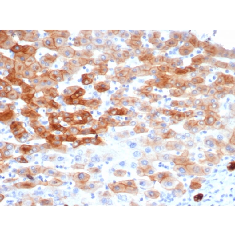 Immunohistochemistry - Anti-Cytokeratin 8 Antibody [rKRT8/6471] (A277897) - Antibodies.com