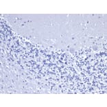 Immunohistochemistry - Anti-Cytokeratin 8 Antibody [rKRT8/6471] (A277897) - Antibodies.com