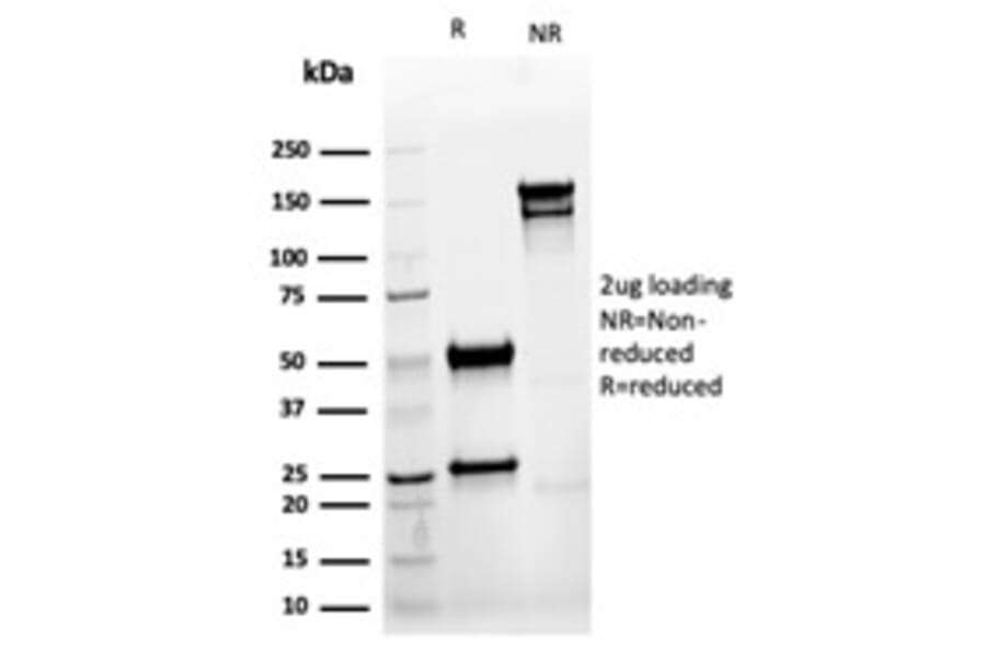 SDS-PAGE - Anti-Cytokeratin 8 Antibody [rKRT8/6471] (A277897) - Antibodies.com