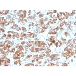 Immunohistochemistry - Anti-Luteinizing Hormone beta Antibody [rLHb/1613] (A277898) - Antibodies.com