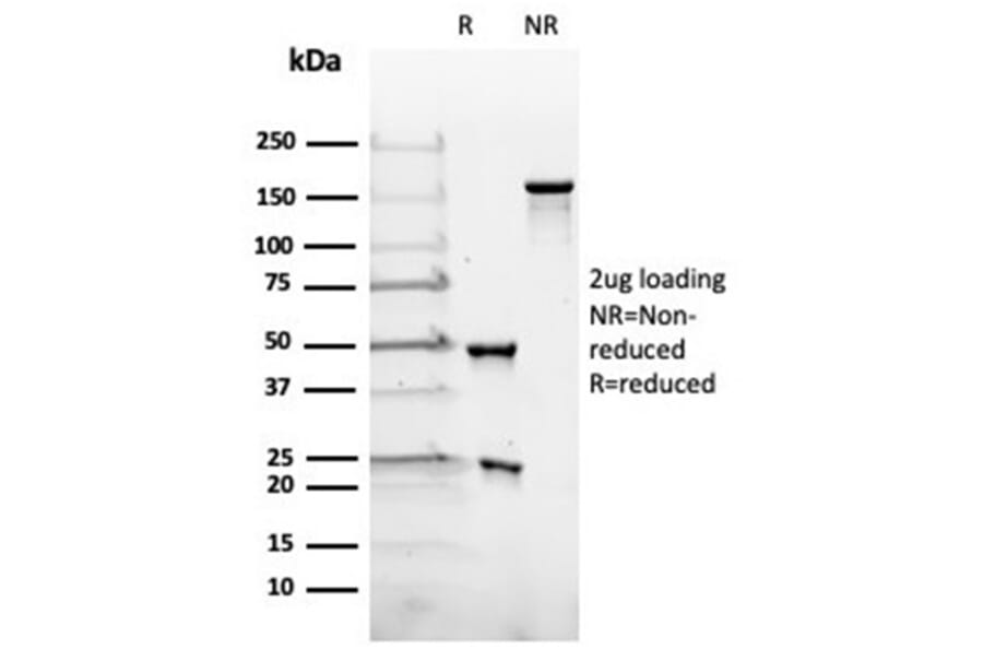 SDS-PAGE - Anti-Luteinizing Hormone beta Antibody [rLHb/1613] (A277898) - Antibodies.com