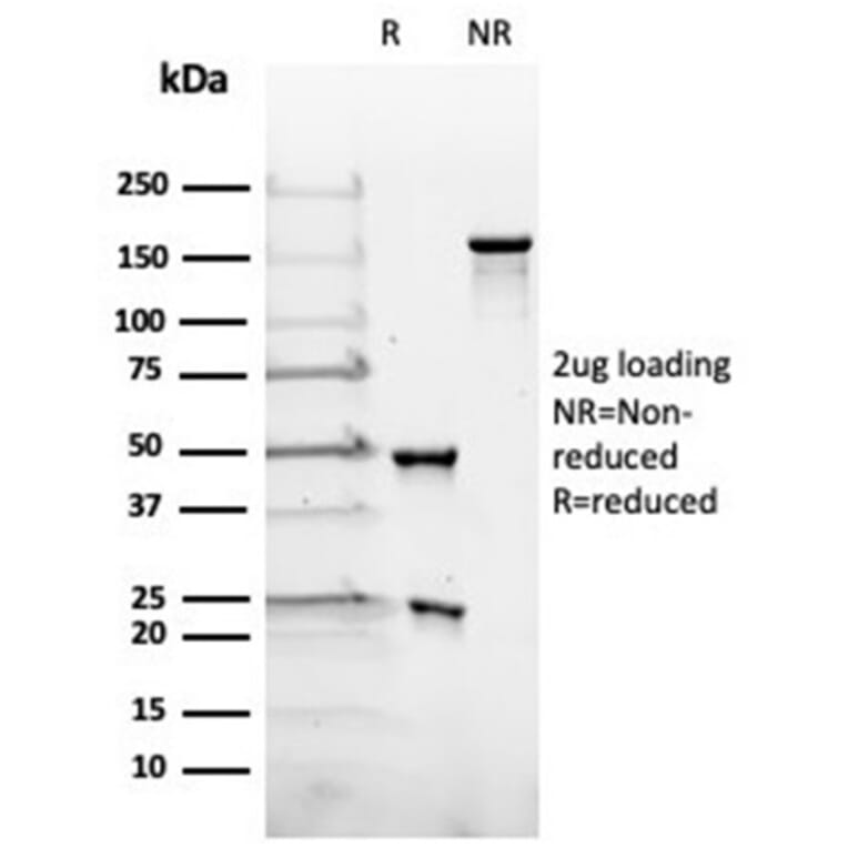 SDS-PAGE - Anti-Luteinizing Hormone beta Antibody [rLHb/1613] (A277898) - Antibodies.com