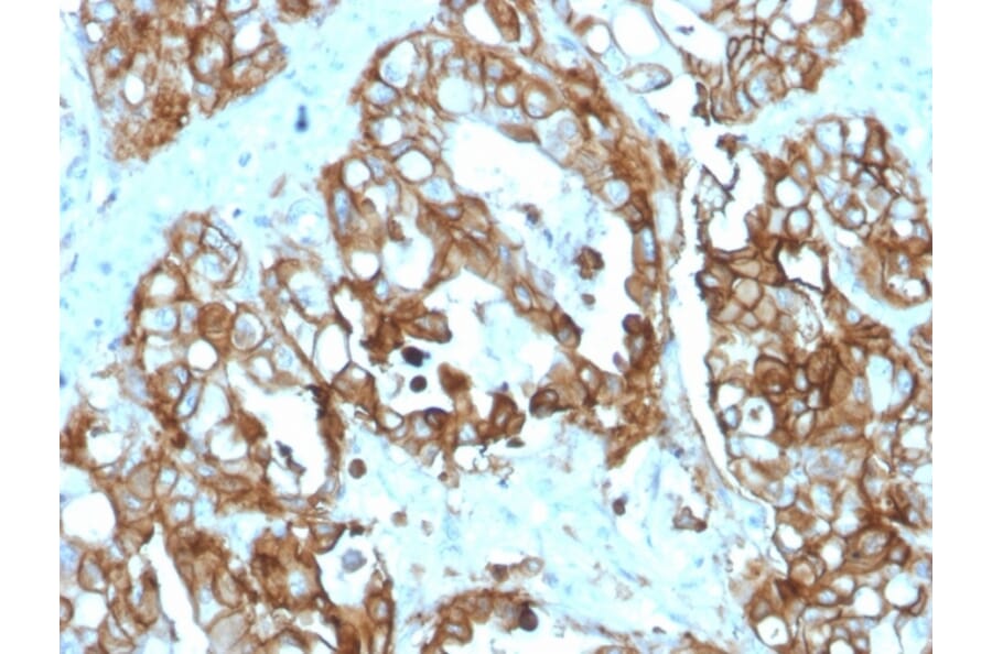 Immunohistochemistry - Anti-TROP2 Antibody [rTACSTD2/6395] (A277899) - Antibodies.com