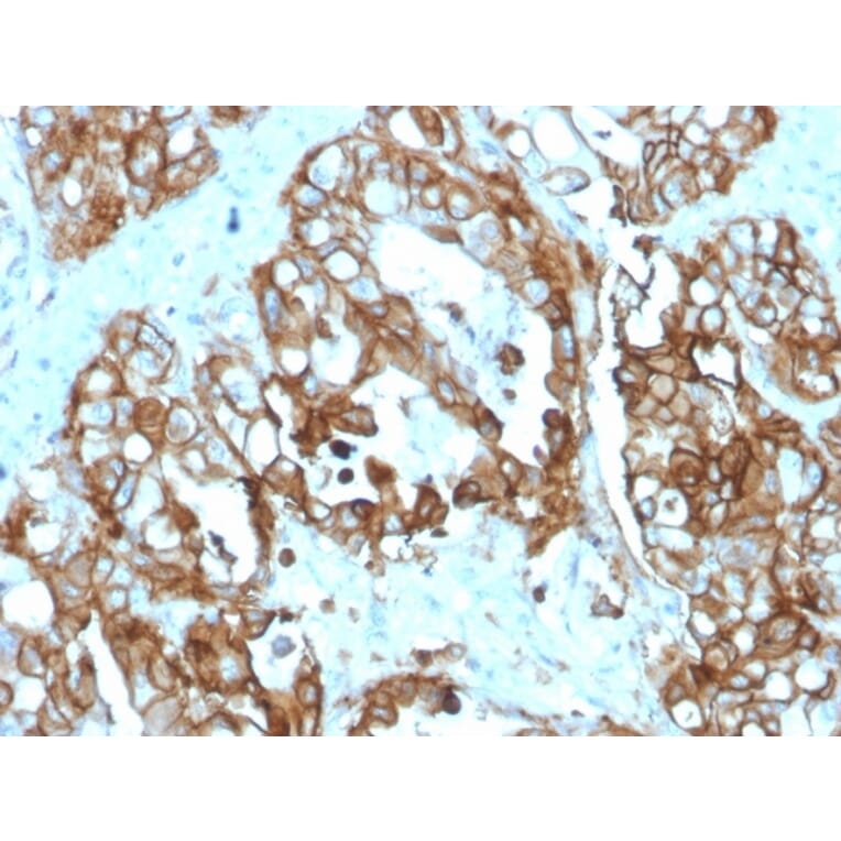 Immunohistochemistry - Anti-TROP2 Antibody [rTACSTD2/6395] (A277899) - Antibodies.com