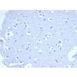 Immunohistochemistry - Anti-TROP2 Antibody [rTACSTD2/6395] (A277899) - Antibodies.com